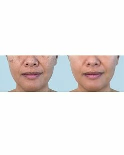 Predire Paris LED Face & Neck Photon Multi-Treatment Mask Women 9 Predire Paris LED Face & Neck Photon Multi-Treatment Mask Women -Peter Thomas Roth shop 1111480902 RLLD 4