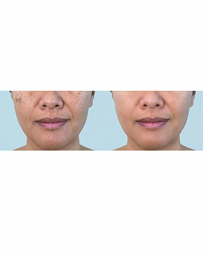 Predire Paris LED Face & Neck Photon Multi-Treatment Mask Women 6 Predire Paris LED Face & Neck Photon Multi-Treatment Mask Women - Image 4