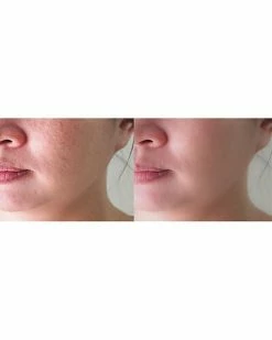 Predire Paris LED 11X Infrared Anti Aging Device Women -Peter Thomas Roth shop 1111632244 RLLD 6