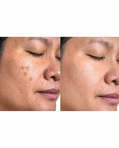 Predire Paris Collagen & Stem Cell Skin Transformation Routine Women 4 Predire Paris Collagen & Stem Cell Skin Transformation Routine Women - Image 2