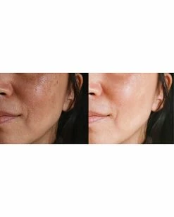 Predire Paris Skin Rejuvenation Device Women 5 Predire Paris Skin Rejuvenation Device Women -Peter Thomas Roth shop 1111939339 RLLD 2