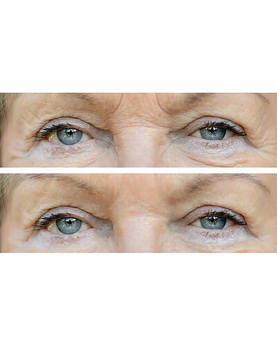 Predire Paris 0.5oz Intensive Rapid Renewal Eye Care Anti Aging Set Women 4 Predire Paris 0.5oz Intensive Rapid Renewal Eye Care Anti Aging Set Women - Image 2